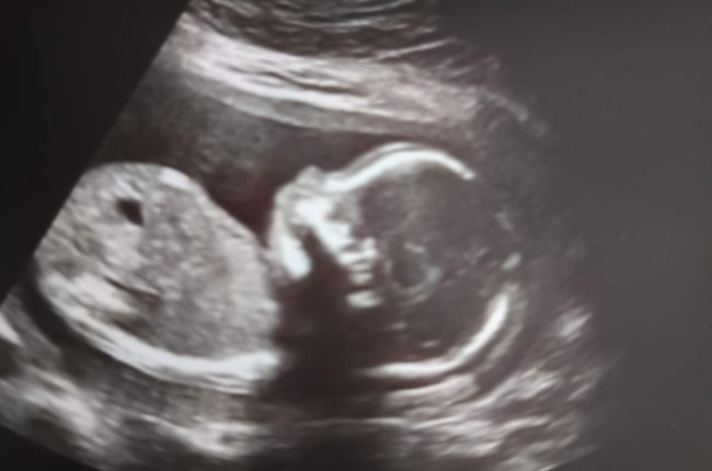 talentos genéticamente