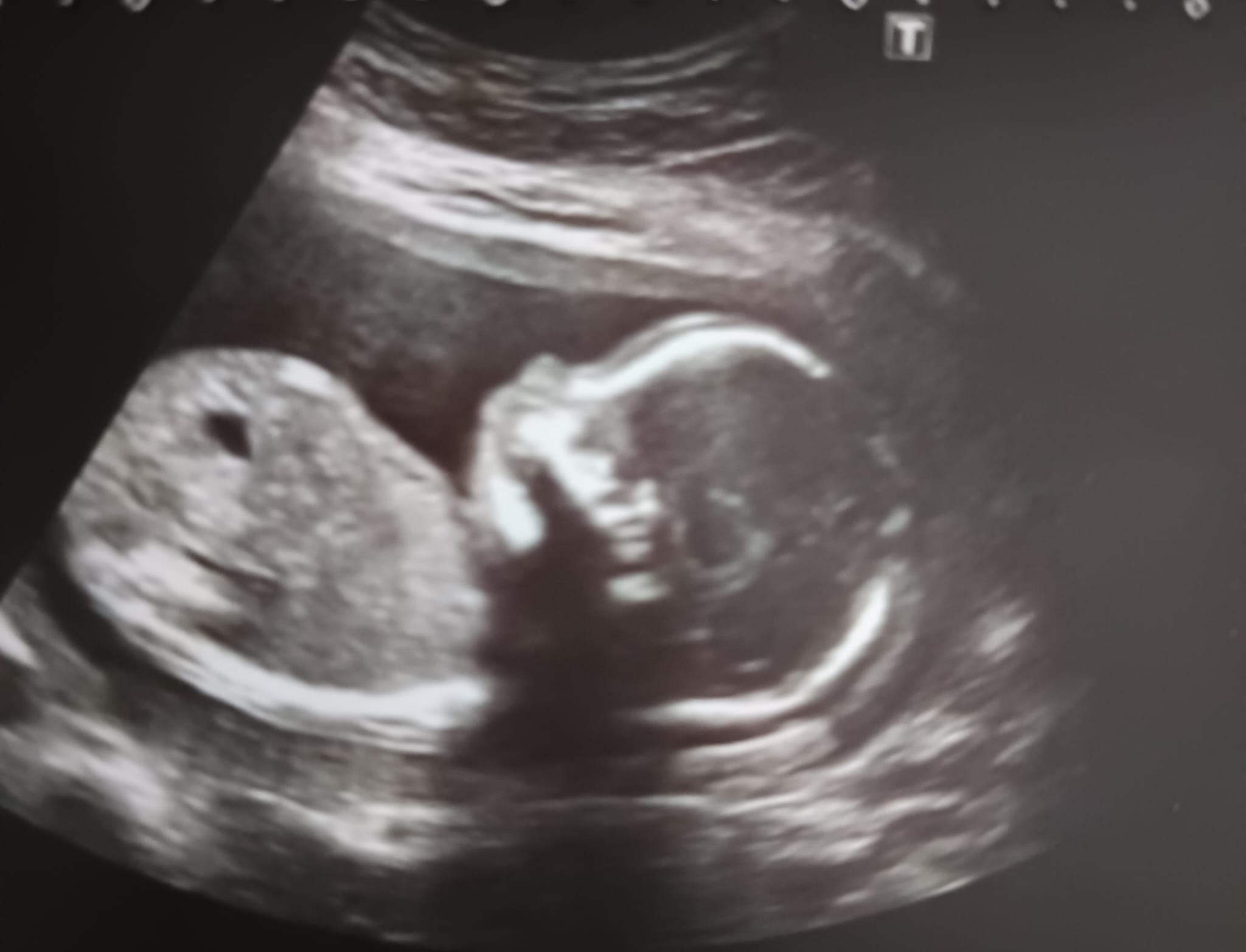 talentos genéticamente